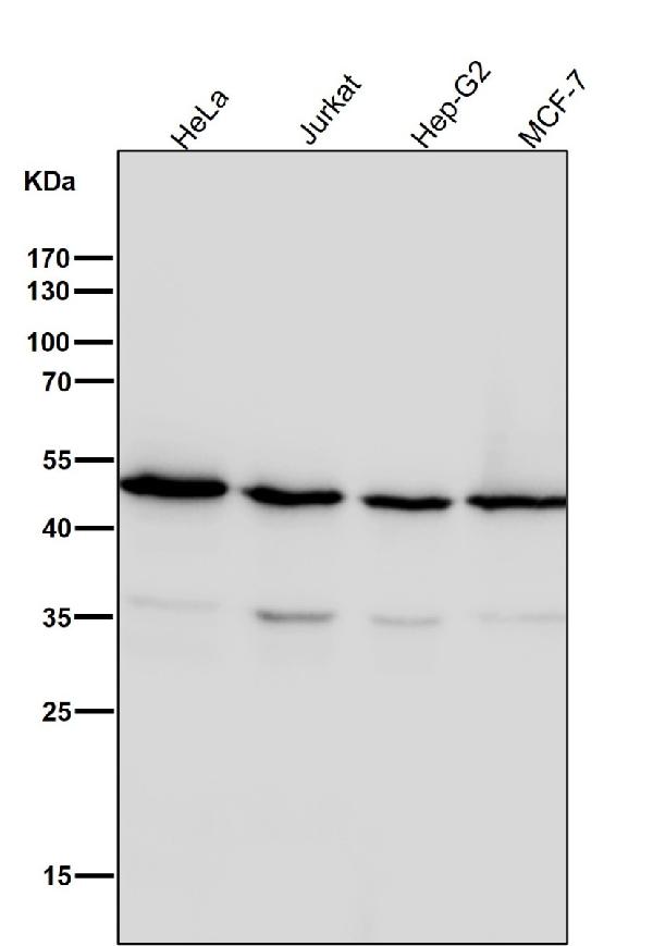 1 - Anti-Tubulin gamma Rabbit Monoclonal Antibody ABO14145