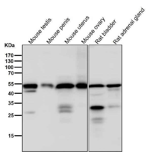 1 - Anti-Tubulin gamma Rabbit Monoclonal Antibody ABO14145