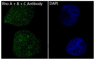 3 - Anti-Rho A + B + C Rabbit Monoclonal Antibody ABO14146