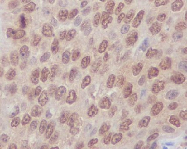 2 - Anti-Rho A + B + C Rabbit Monoclonal Antibody ABO14146