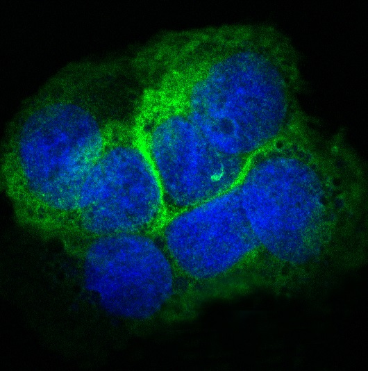 3 - Anti-Collagen XVII Rabbit Monoclonal Antibody ABO14147