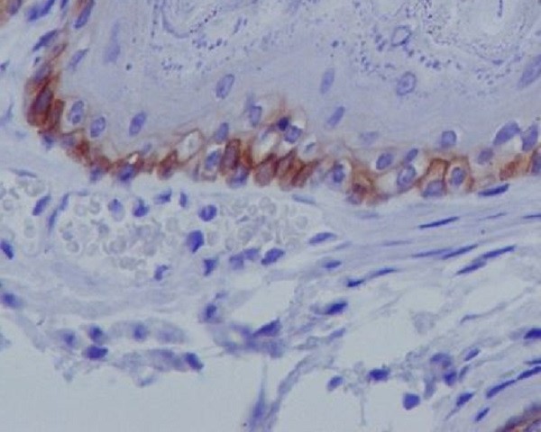 2 - Anti-Collagen XVII Rabbit Monoclonal Antibody ABO14147