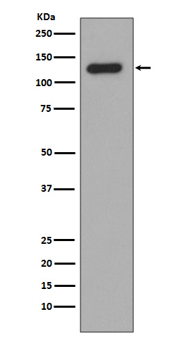 1 - Anti-Collagen XVII Rabbit Monoclonal Antibody ABO14147