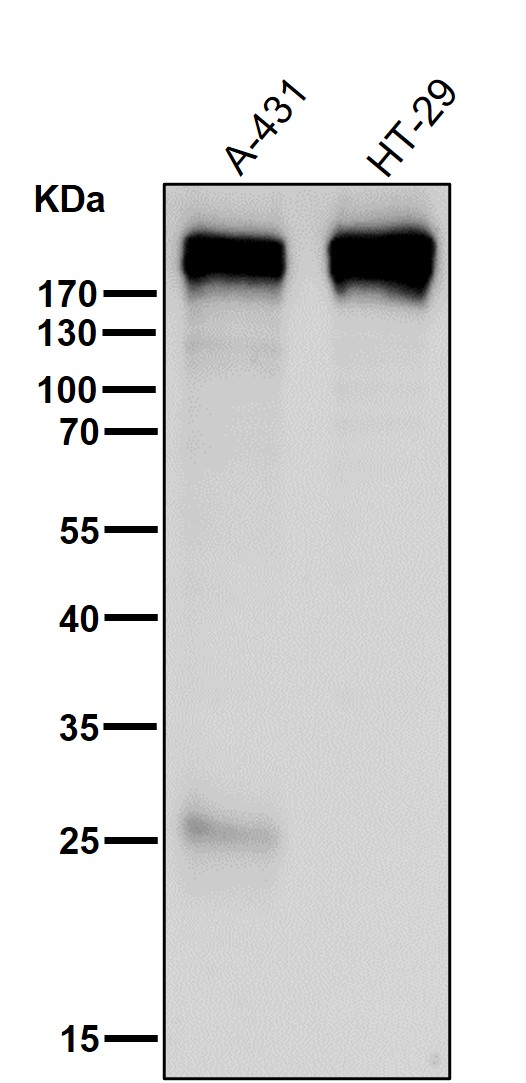 1 - Anti-Collagen XVII Rabbit Monoclonal Antibody ABO14147