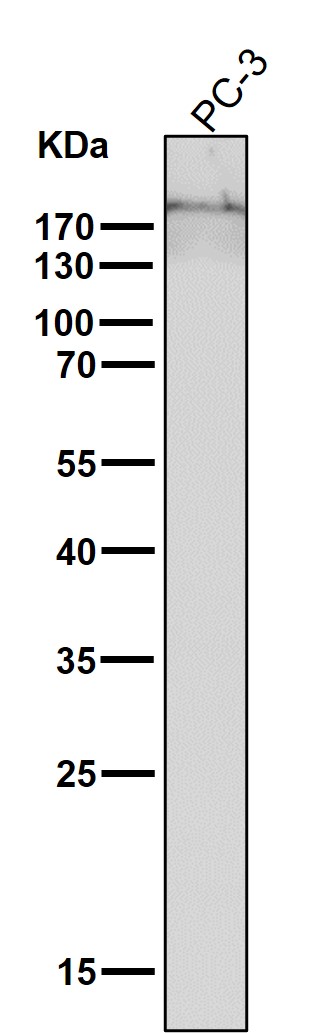 1 - Anti-Collagen XVII Rabbit Monoclonal Antibody ABO14147