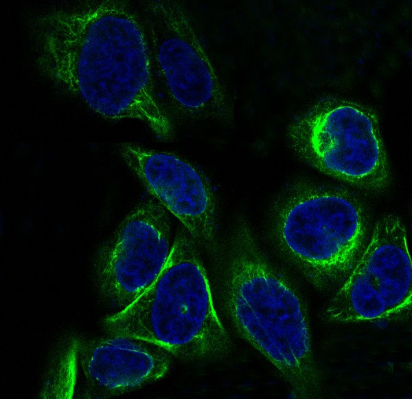 3 - Anti-Cytokeratin 7 KRT7 Rabbit Monoclonal Antibody ABO14149