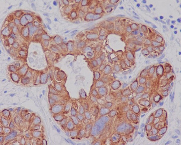 2 - Anti-Cytokeratin 7 KRT7 Rabbit Monoclonal Antibody ABO14149