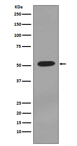 1 - Anti-Cytokeratin 7 KRT7 Rabbit Monoclonal Antibody ABO14149
