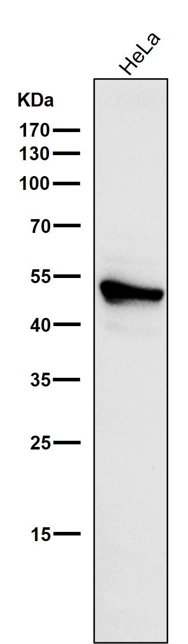 1 - Anti-Cytokeratin 7 KRT7 Rabbit Monoclonal Antibody ABO14149