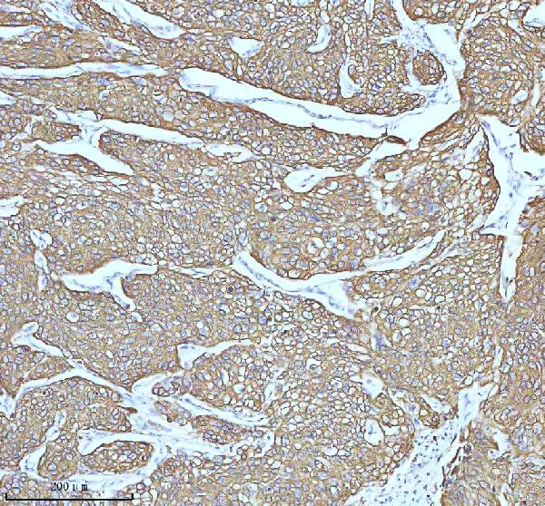 2 - Anti-Cytokeratin 5 KRT5 Rabbit Monoclonal Antibody ABO14151
