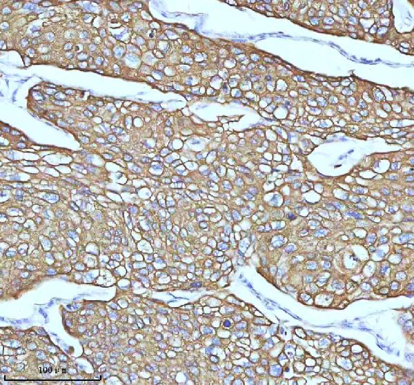 2 - Anti-Cytokeratin 5 KRT5 Rabbit Monoclonal Antibody ABO14151