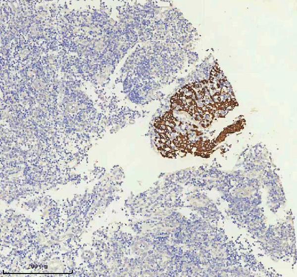 2 - Anti-Cytokeratin 5 KRT5 Rabbit Monoclonal Antibody ABO14151