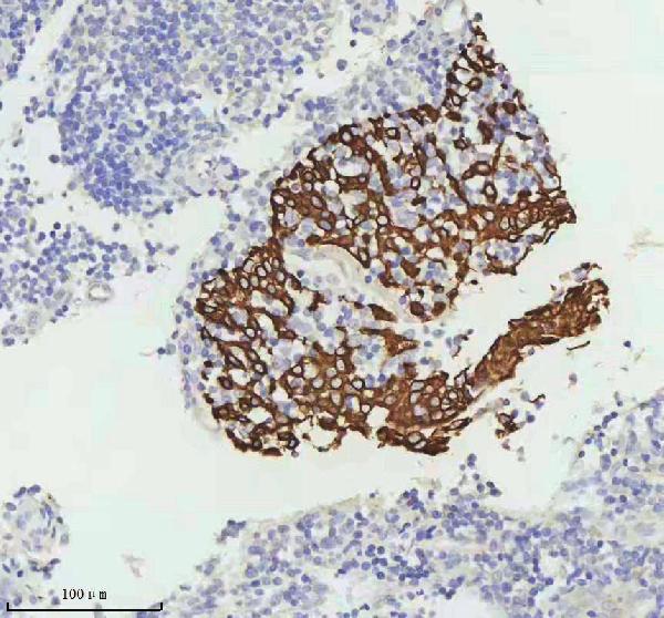 2 - Anti-Cytokeratin 5 KRT5 Rabbit Monoclonal Antibody ABO14151