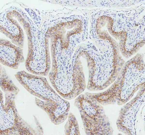 2 - Anti-Cytokeratin 5 KRT5 Rabbit Monoclonal Antibody ABO14151