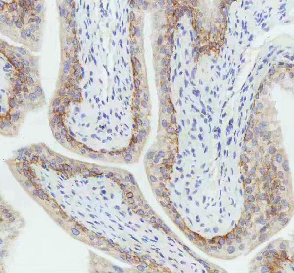 2 - Anti-Cytokeratin 5 KRT5 Rabbit Monoclonal Antibody ABO14151
