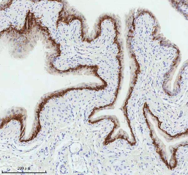 2 - Anti-Cytokeratin 5 KRT5 Rabbit Monoclonal Antibody ABO14151