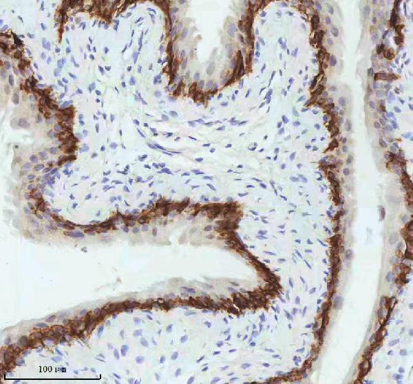 2 - Anti-Cytokeratin 5 KRT5 Rabbit Monoclonal Antibody ABO14151