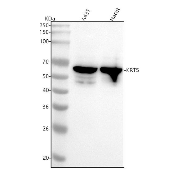 1 - Anti-Cytokeratin 5 KRT5 Rabbit Monoclonal Antibody ABO14151