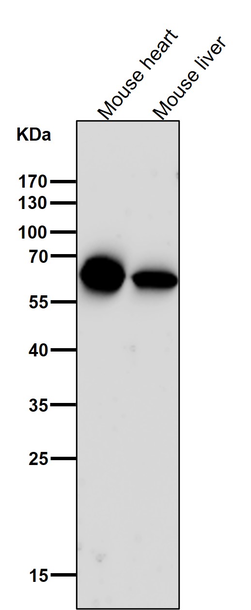 1 - Anti-Cytokeratin 5 KRT5 Rabbit Monoclonal Antibody ABO14151