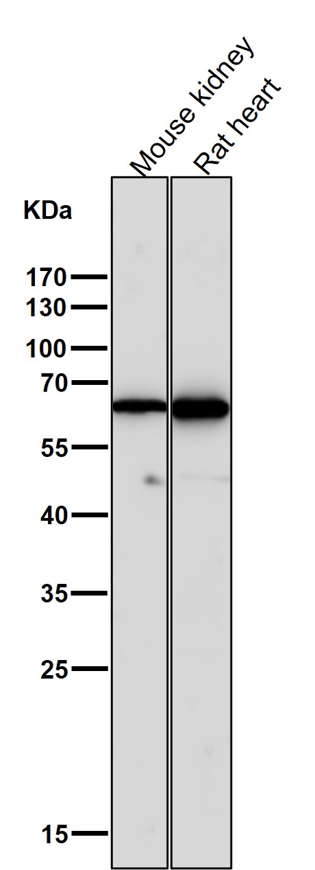 1 - Anti-Cytokeratin 5 KRT5 Rabbit Monoclonal Antibody ABO14151