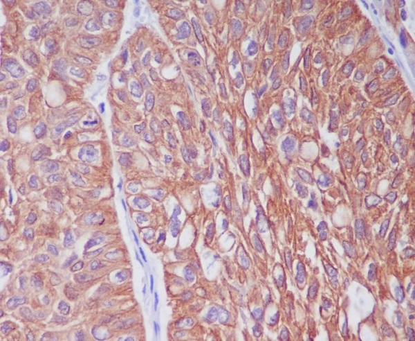 2 - Anti-Cytokeratin 6 Rabbit Monoclonal Antibody ABO14152