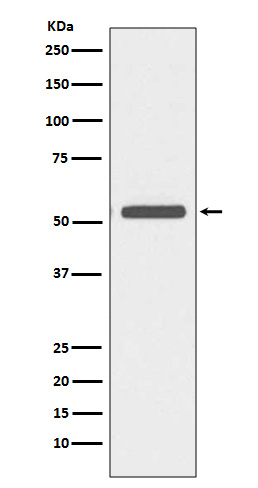 1 - Anti-Cytokeratin 6 Rabbit Monoclonal Antibody ABO14152