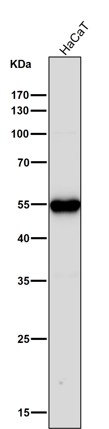1 - Anti-Cytokeratin 6 Rabbit Monoclonal Antibody ABO14152