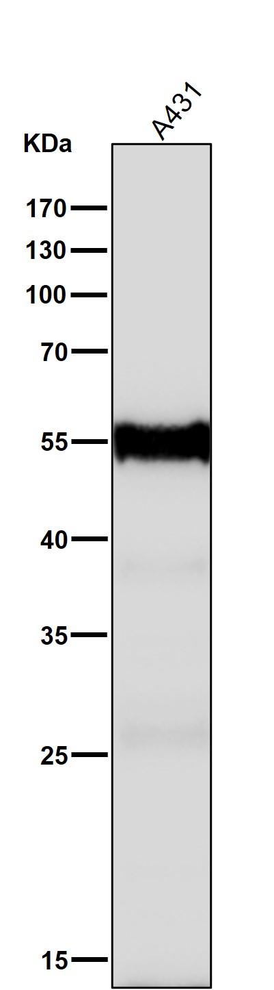 1 - Anti-Cytokeratin 6 Rabbit Monoclonal Antibody ABO14152