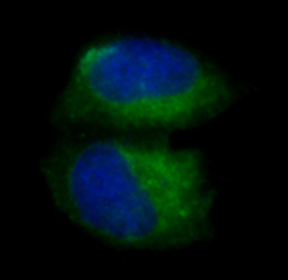 3 - Anti-pro Caspase 3 CASP3 Rabbit Monoclonal Antibody ABO14153