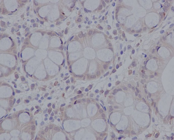 2 - Anti-pro Caspase 3 CASP3 Rabbit Monoclonal Antibody ABO14153