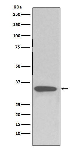 1 - Anti-pro Caspase 3 CASP3 Rabbit Monoclonal Antibody ABO14153