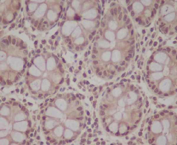 2 - Anti-pro Caspase 9 CASP9 Rabbit Monoclonal Antibody ABO14154