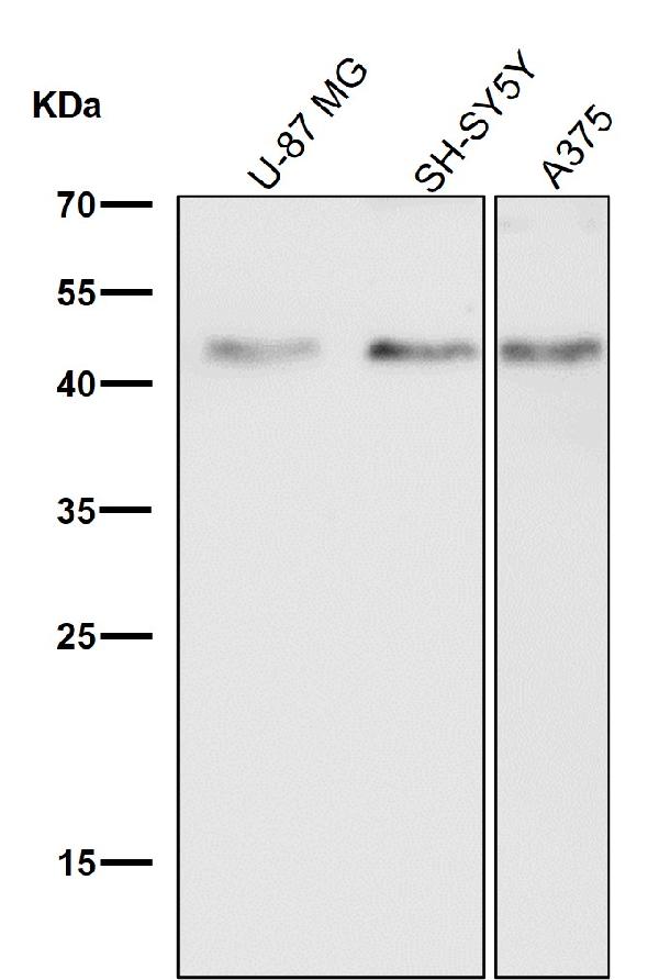 1 - Anti-pro Caspase 9 CASP9 Rabbit Monoclonal Antibody ABO14154