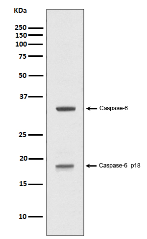 1 - Anti-Caspase-6 p18 CASP6 Rabbit Monoclonal Antibody ABO14155