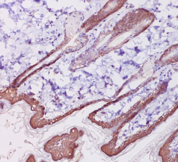 2 - Anti-Cytokeratin 1 Rabbit Monoclonal Antibody ABO14156