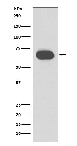 1 - Anti-Cytokeratin 1 Rabbit Monoclonal Antibody ABO14156