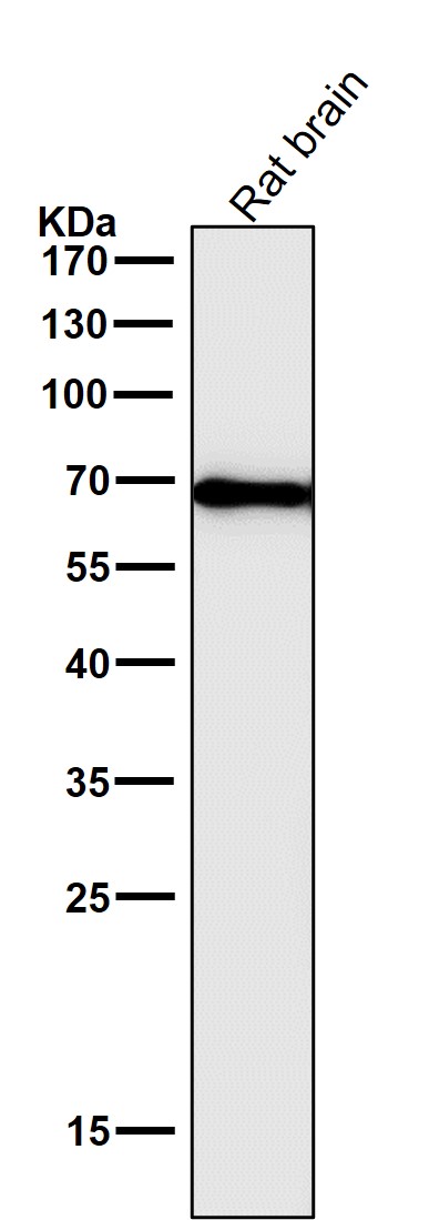 1 - Anti-Cytokeratin 1 Rabbit Monoclonal Antibody ABO14156