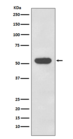 1 - Anti-Cytokeratin 4 KRT4 Rabbit Monoclonal Antibody ABO14157