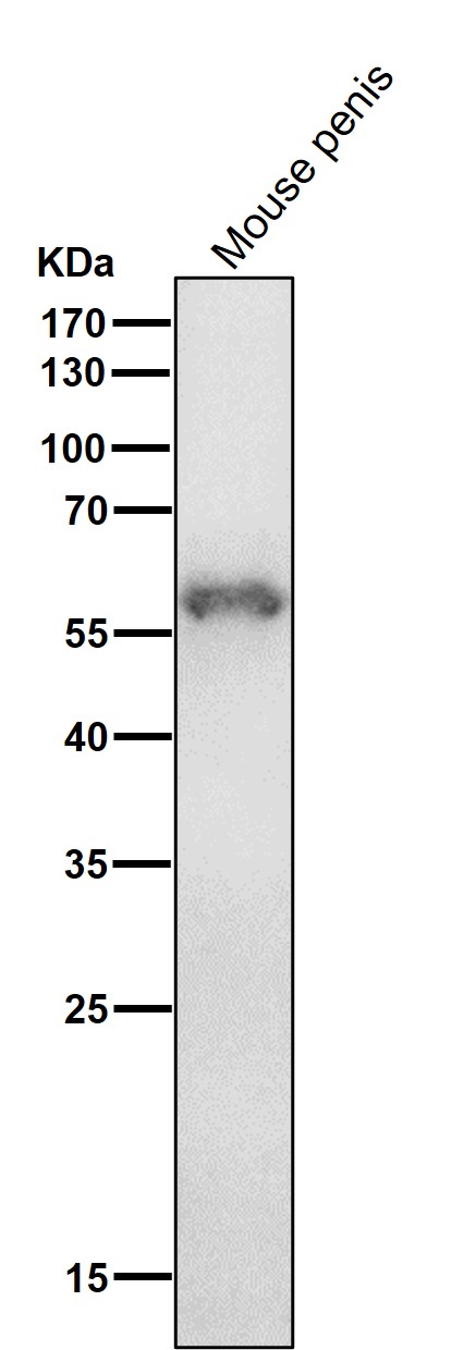 1 - Anti-Cytokeratin 4 KRT4 Rabbit Monoclonal Antibody ABO14157