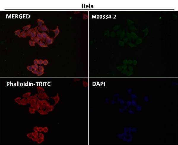 1 - Anti-Caspase-3 p12 CASP3 Rabbit Monoclonal Antibody ABO14158