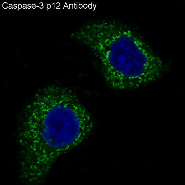 3 - Anti-Caspase-3 p12 CASP3 Rabbit Monoclonal Antibody ABO14158