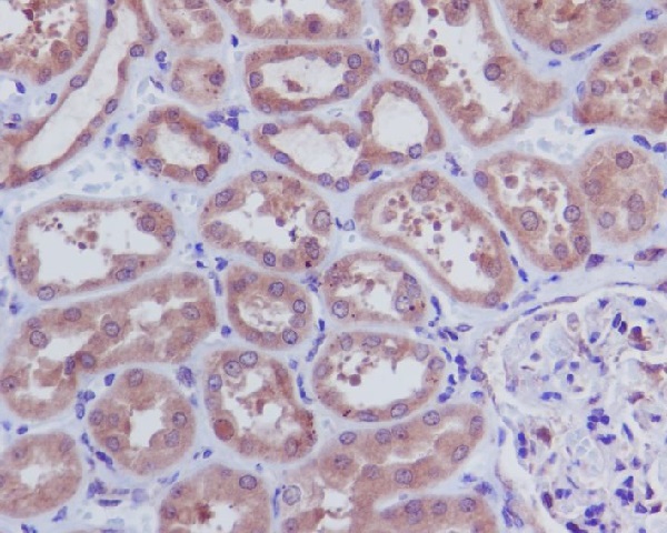 2 - Anti-Caspase-3 p12 CASP3 Rabbit Monoclonal Antibody ABO14158