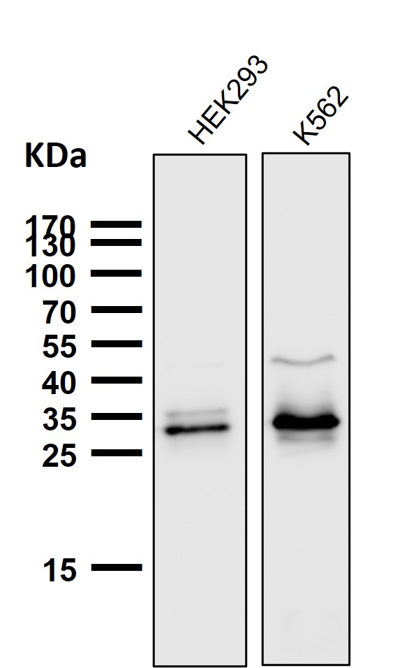 1 - Anti-Caspase-3 p12 CASP3 Rabbit Monoclonal Antibody ABO14158