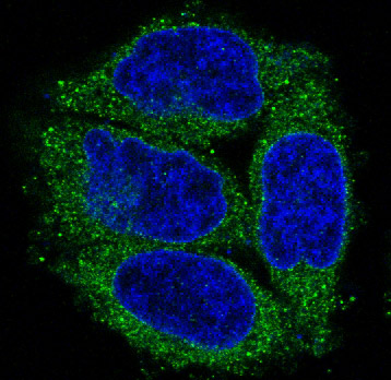 3 - Anti-Cytokeratin 7 KRT7 Rabbit Monoclonal Antibody ABO14159