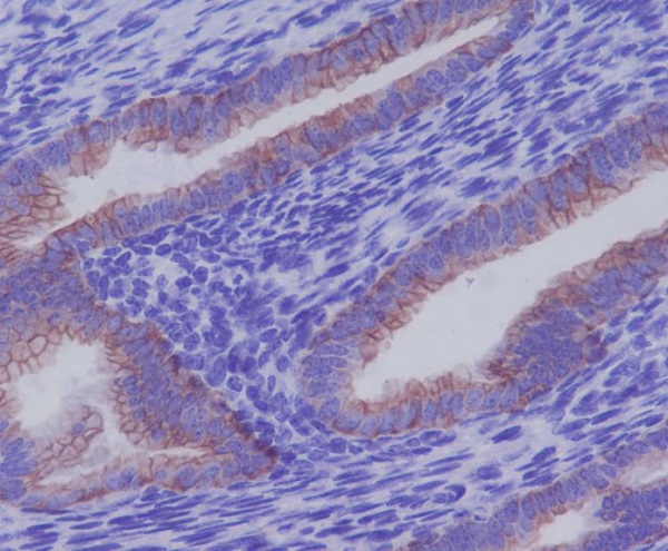 2 - Anti-Cytokeratin 7 KRT7 Rabbit Monoclonal Antibody ABO14159