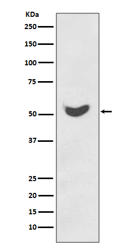1 - Anti-Cytokeratin 7 KRT7 Rabbit Monoclonal Antibody ABO14159