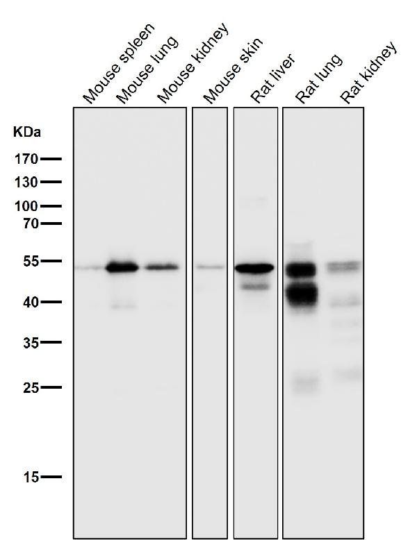 1 - Anti-Cytokeratin 7 KRT7 Rabbit Monoclonal Antibody ABO14159