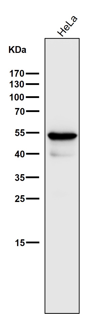 1 - Anti-Cytokeratin 7 KRT7 Rabbit Monoclonal Antibody ABO14159