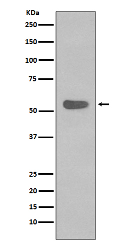 1 - Anti-Cytokeratin 4 KRT4 Rabbit Monoclonal Antibody ABO14160