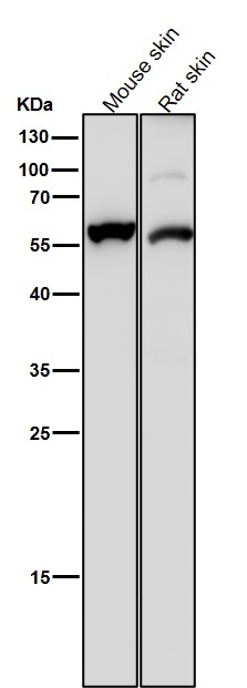 1 - Anti-Cytokeratin 4 KRT4 Rabbit Monoclonal Antibody ABO14160